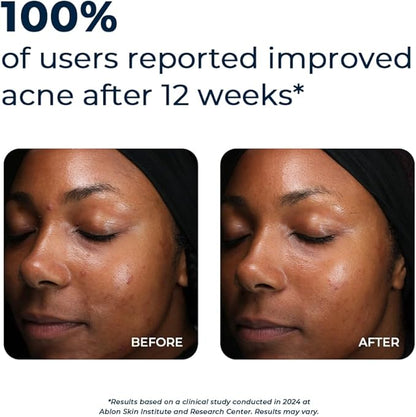 VitaMedica Clear Skin Vitamin Formula | Acne Supplement for Skin Clearing | Breakout Treatment for Women and Men | Vitamins A, C, E, Selenium, Chromium, and Zinc for Acne and Skin Health | 2 Pack