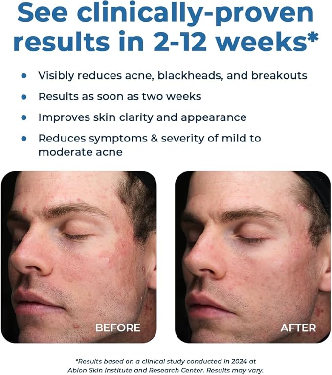 VitaMedica Clear Skin Vitamin Formula | Acne Supplement for Skin Clearing | Breakout Treatment for Women and Men | Vitamins A, C, E, Selenium, Chromium, and Zinc for Acne and Skin Health | 2 Pack